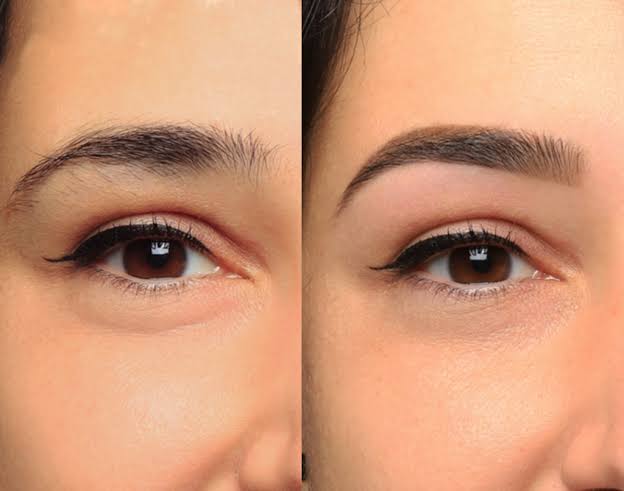 Reconstruction des sourcils